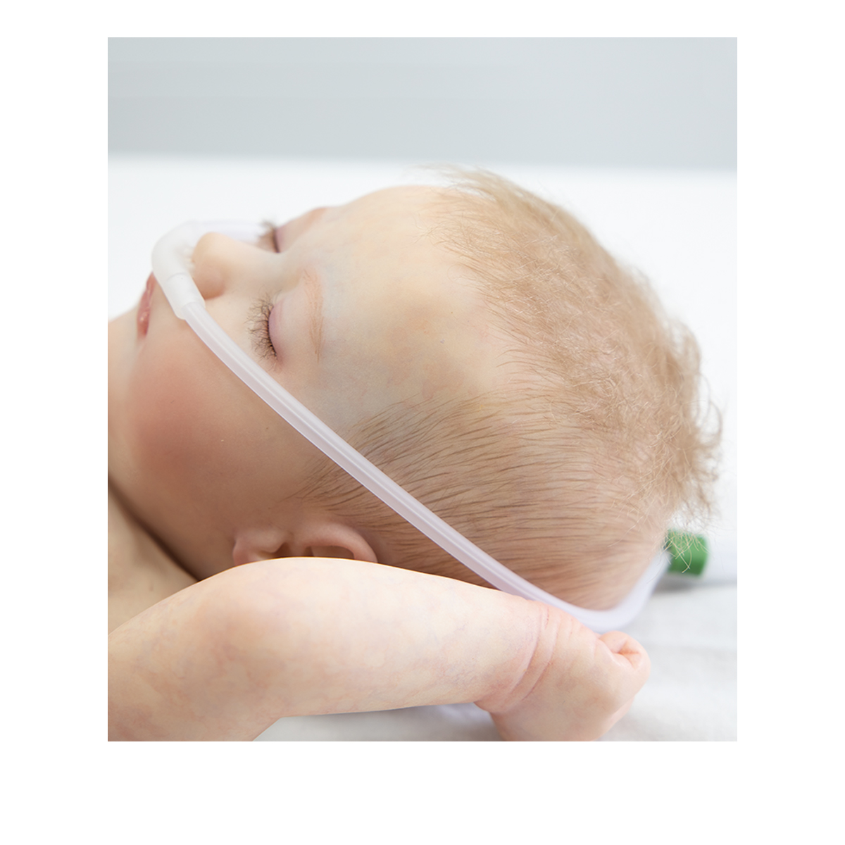 NioNFlo High Flow Nasal Cannula