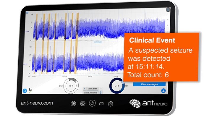 The aEEG Neuromonitoring for Neonatal Care